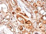 MICA Antibody in Immunohistochemistry (Paraffin) (IHC (P))