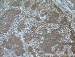 SHC Antibody in Immunohistochemistry (Paraffin) (IHC (P))