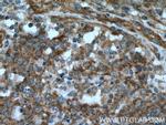 SHC Antibody in Immunohistochemistry (Paraffin) (IHC (P))