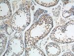SNAPIN Antibody in Immunohistochemistry (Paraffin) (IHC (P))