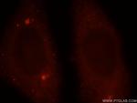 SNAPIN Antibody in Immunocytochemistry (ICC/IF)