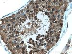 FKBPL Antibody in Immunohistochemistry (Paraffin) (IHC (P))