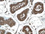FKBPL Antibody in Immunohistochemistry (Paraffin) (IHC (P))