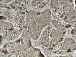 FKBPL Antibody in Immunohistochemistry (Paraffin) (IHC (P))