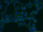 OS9 Antibody in Immunocytochemistry (ICC/IF)