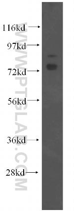 OS9 Antibody in Western Blot (WB)