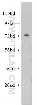 OS9 Antibody in Western Blot (WB)