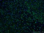 Notch1 Antibody in Immunohistochemistry (Paraffin) (IHC (P))