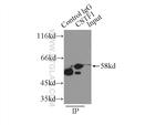 CSTF1 Antibody in Immunoprecipitation (IP)