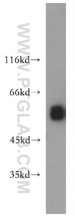 CSTF1 Antibody in Western Blot (WB)