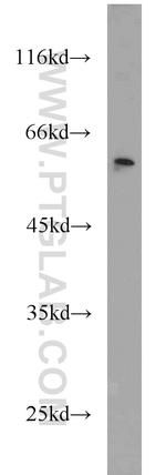 CSTF1 Antibody in Western Blot (WB)