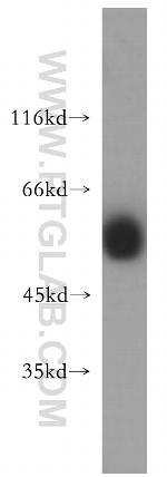 CSTF1 Antibody in Western Blot (WB)