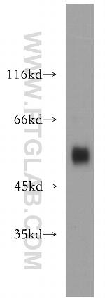 CSTF1 Antibody in Western Blot (WB)