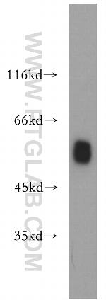 CSTF1 Antibody in Western Blot (WB)