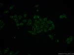 HINFP Antibody in Immunocytochemistry (ICC/IF)