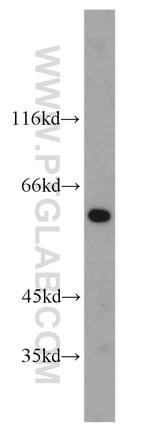 HINFP Antibody in Western Blot (WB)