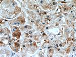 RB1CC1 Antibody in Immunohistochemistry (Paraffin) (IHC (P))