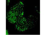 Amyloid Beta A4 Precursor (APP) Antibody in Immunocytochemistry (ICC/IF)