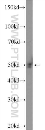 GAS7 Antibody in Western Blot (WB)