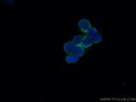 Recoverin Antibody in Immunocytochemistry (ICC/IF)