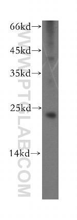 Recoverin Antibody in Western Blot (WB)