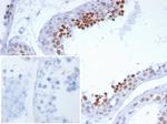 NUT1/NUTM1/Snurportin 1 Antibody in Immunohistochemistry (Paraffin) (IHC (P))