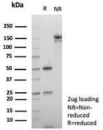 NUT1/NUTM1/Snurportin 1 Antibody in SDS-PAGE (SDS-PAGE)