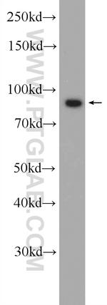 Importin beta Antibody in Western Blot (WB)