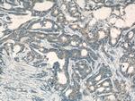 PKM Antibody in Immunohistochemistry (Paraffin) (IHC (P))