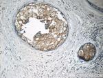 MATK Antibody in Immunohistochemistry (Paraffin) (IHC (P))