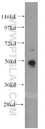 MATK Antibody in Western Blot (WB)