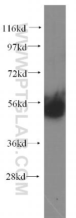 MATK Antibody in Western Blot (WB)