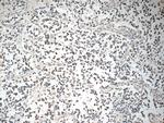 COPS8/COP9 Antibody in Immunohistochemistry (Paraffin) (IHC (P))