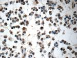 COPS8/COP9 Antibody in Immunohistochemistry (Paraffin) (IHC (P))