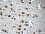 COPS8/COP9 Antibody in Immunohistochemistry (Paraffin) (IHC (P))