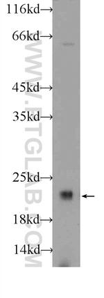 COPS8/COP9 Antibody in Western Blot (WB)