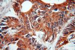 NOB1 Antibody in Immunohistochemistry (Paraffin) (IHC (P))
