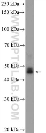 NOB1 Antibody in Western Blot (WB)