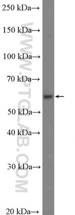 KCNS3 Antibody in Western Blot (WB)