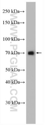 GTF2F1 Antibody in Western Blot (WB)