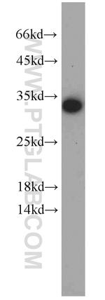 EEF1B2 Antibody in Western Blot (WB)