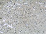 TFPT Antibody in Immunohistochemistry (Paraffin) (IHC (P))