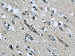 TFPT Antibody in Immunohistochemistry (Paraffin) (IHC (P))
