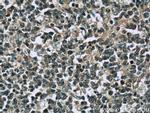 TFPT Antibody in Immunohistochemistry (Paraffin) (IHC (P))