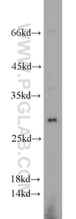 TFPT Antibody in Western Blot (WB)