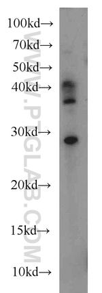 TFPT Antibody in Western Blot (WB)