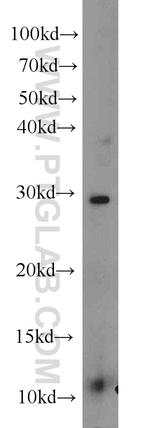 TFPT Antibody in Western Blot (WB)