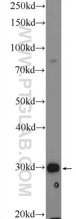 TFPT Antibody in Western Blot (WB)