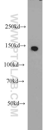 DHX38 Antibody in Western Blot (WB)