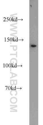 DHX38 Antibody in Western Blot (WB)